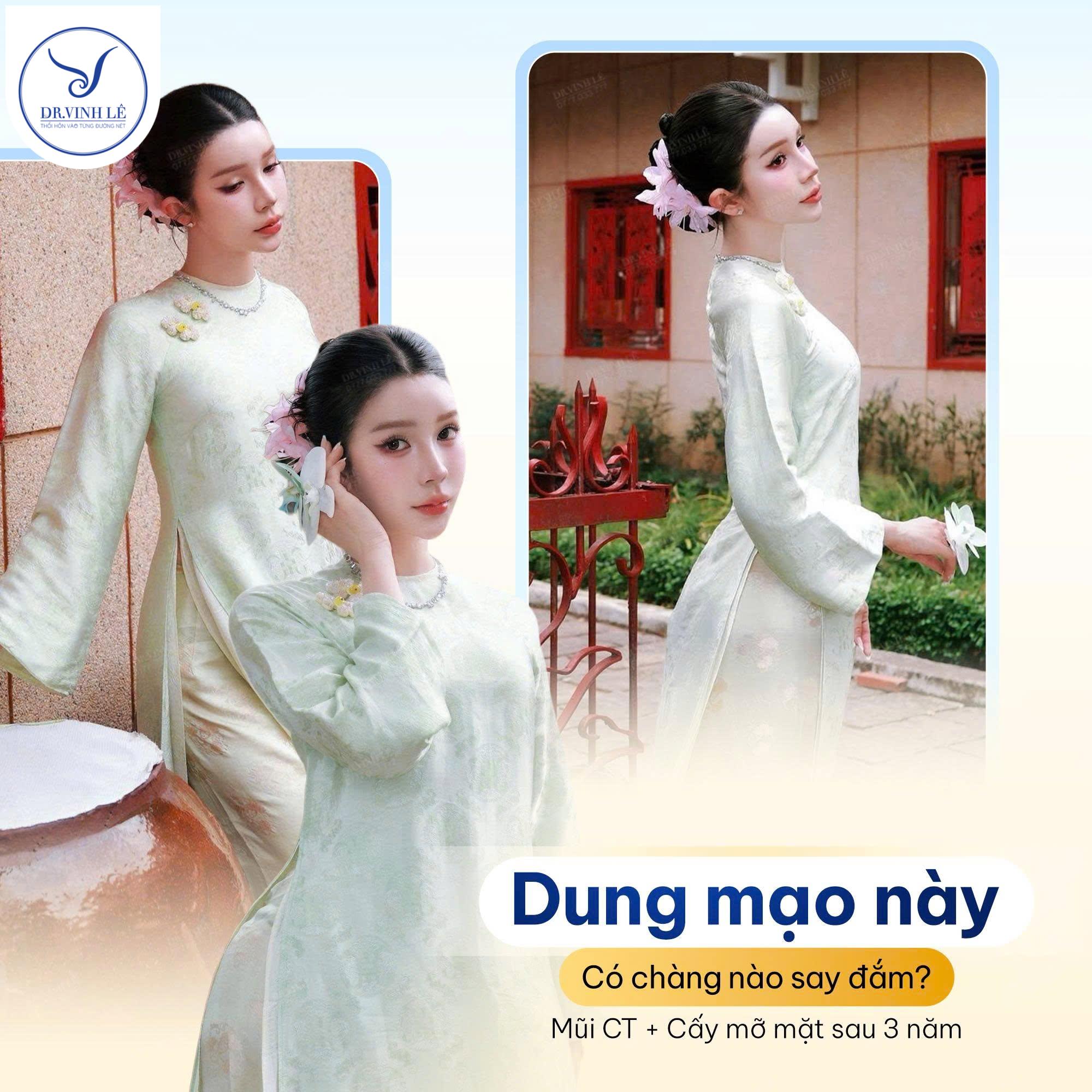 Hình ảnh Feedback của khách hàng sau nâng mũi cấu trúc + cấy mỡ mặt tại Dr.Vinh Lê.