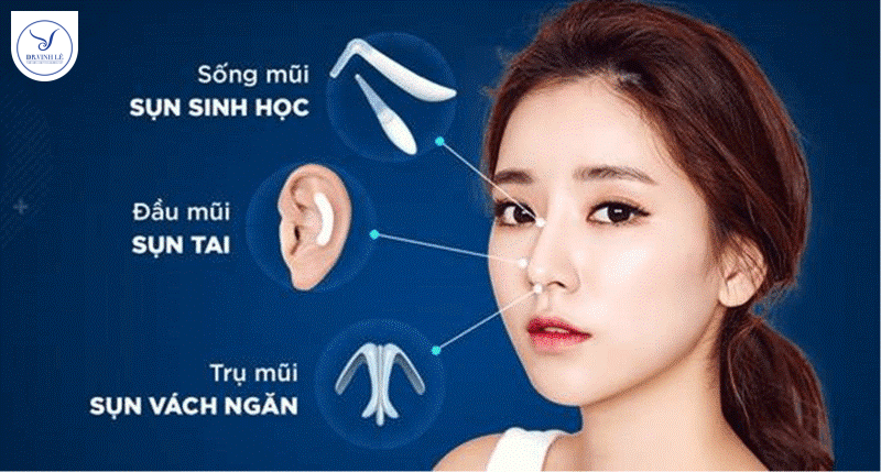 Nâng mũi cấu trúc sụn Surgiform - Giải pháp bền vững, đầu mũi tự nhiên.