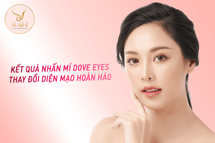 Nhấn mí Dove eyes ở Dr Vinh Lê, thay đổi diện mạo hoàn hảo