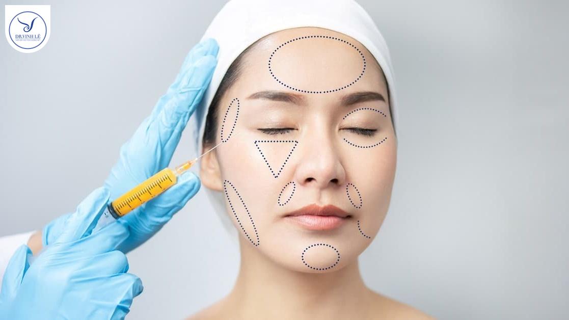 Cấy mỡ mặt Baby Face - Trẻ hóa toàn diện, bền vững 10 năm.