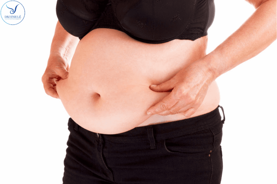 Mỡ bụng và nguyên nhân hình thành mỡ bụng