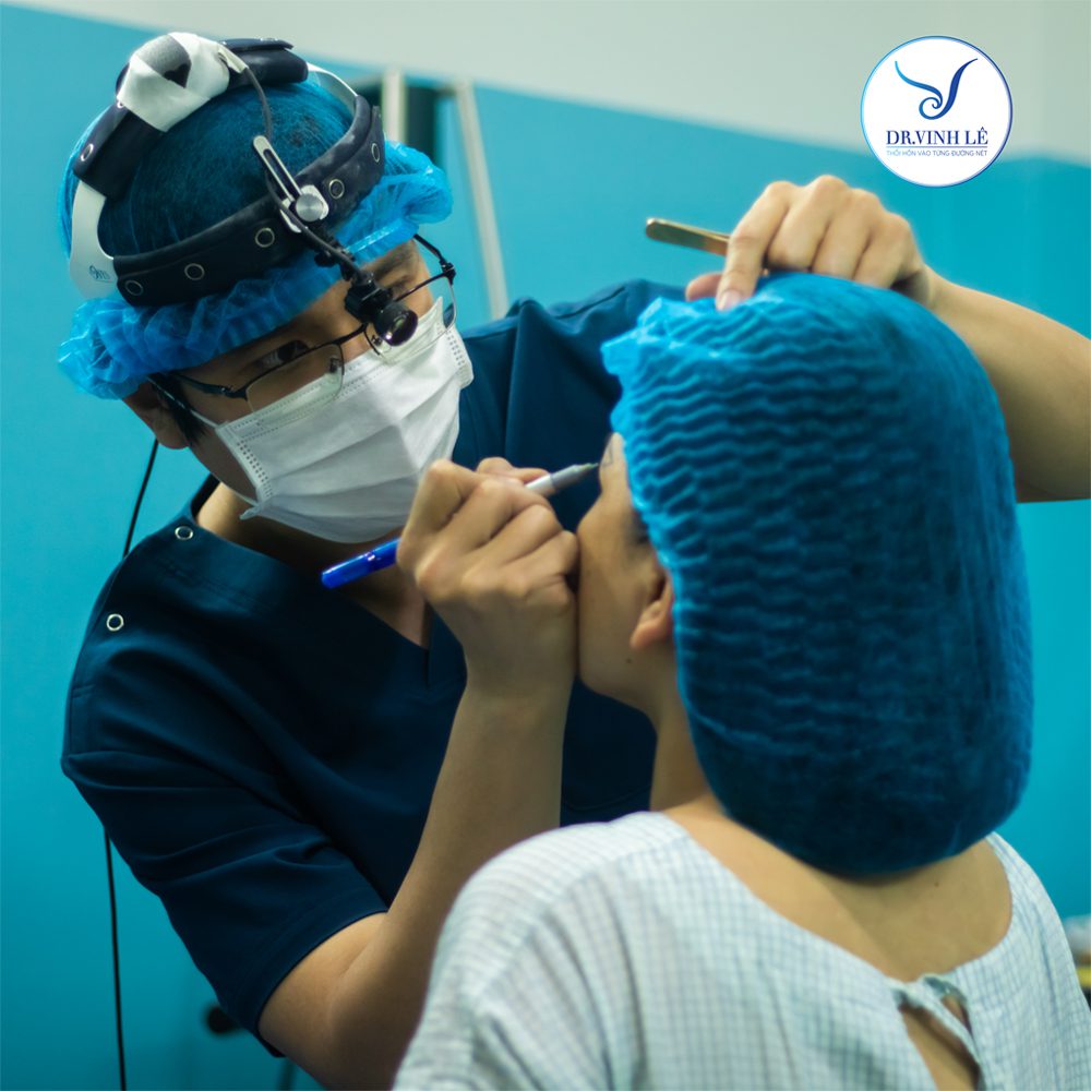 Thạc Sĩ Bác Sĩ Lê Hoàng Vinh trực tiếp thực hiện phẫu thuật sửa lại mắt cắt hỏng