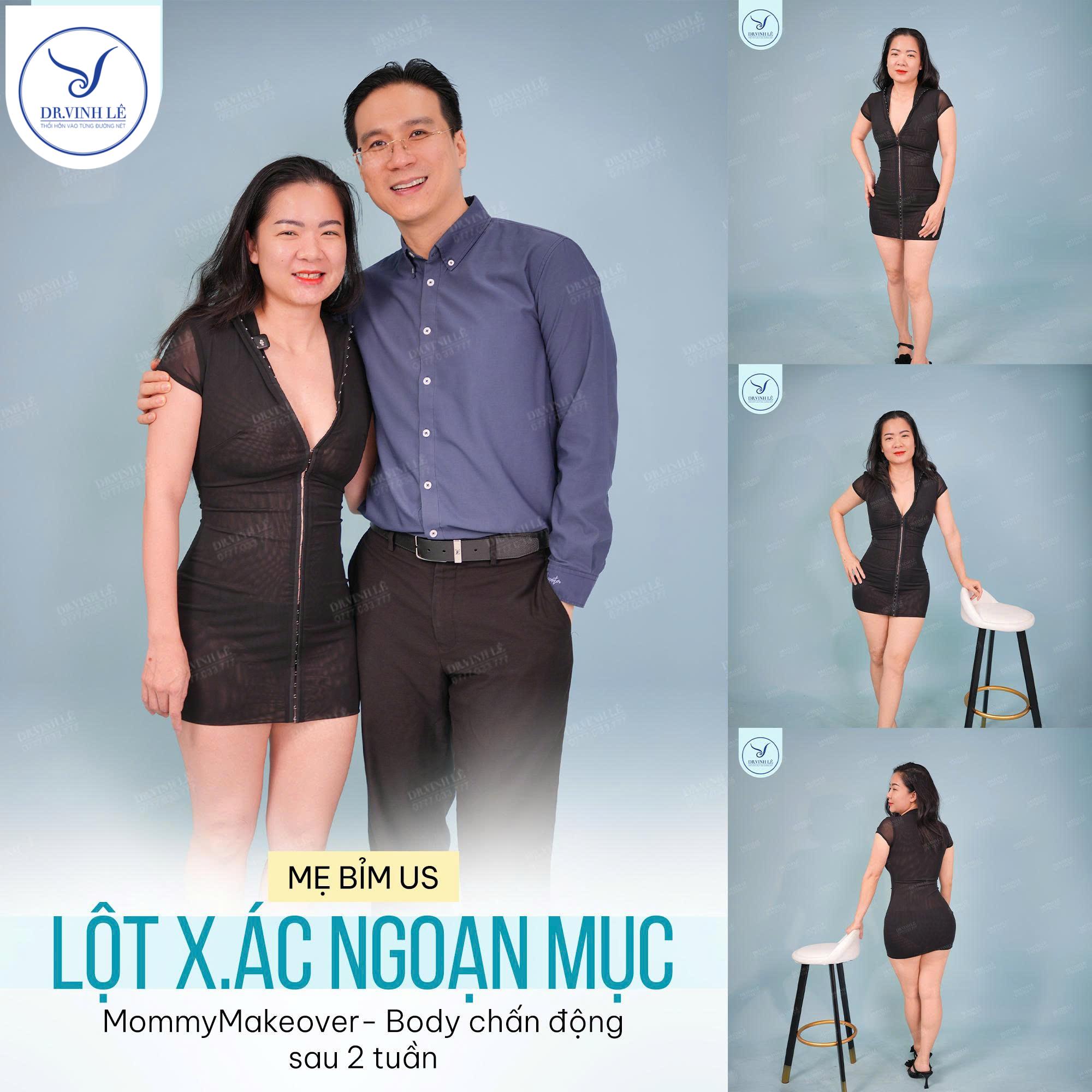 Bác sĩ Lê Hoàng Vinh cùng chị khách Việt Kiều US "Hút Mỡ Siết Eo – Cấy Mỡ Mông".