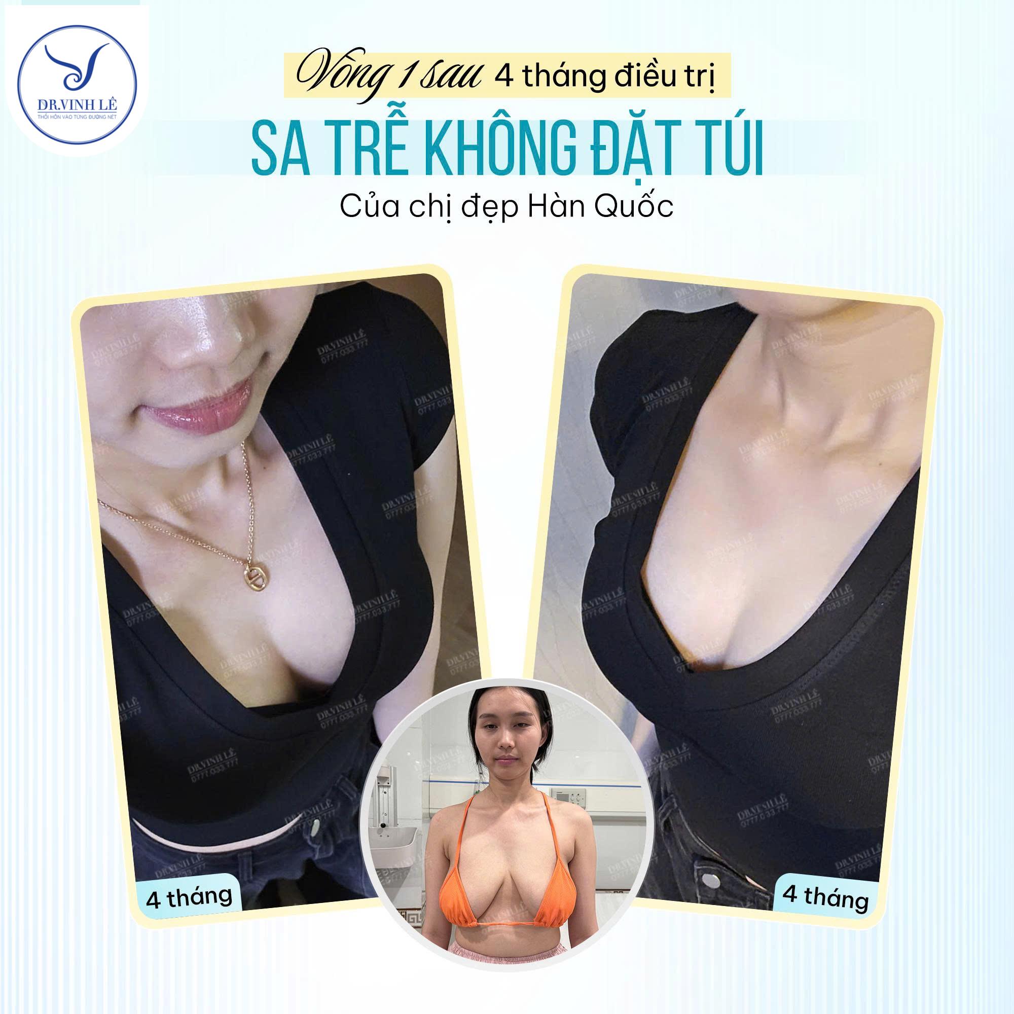 Treo sa trễ không đặt túi của chị đẹp Hàn Quốc.