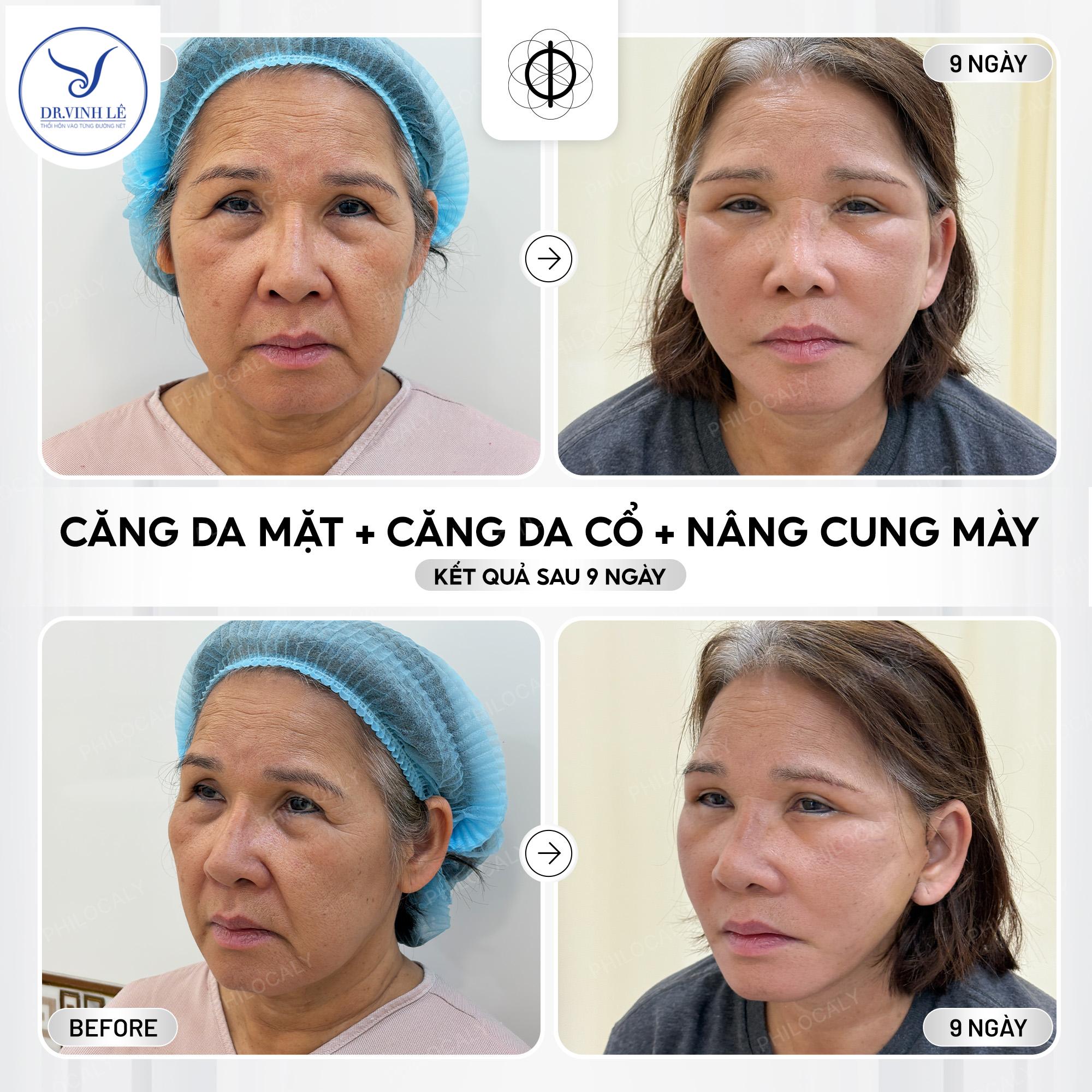 Bác sĩ Huỳnh Tấn Đạt | Được xem là Thiên tài khắc chế trong các ca thẩm mỹ hỏng