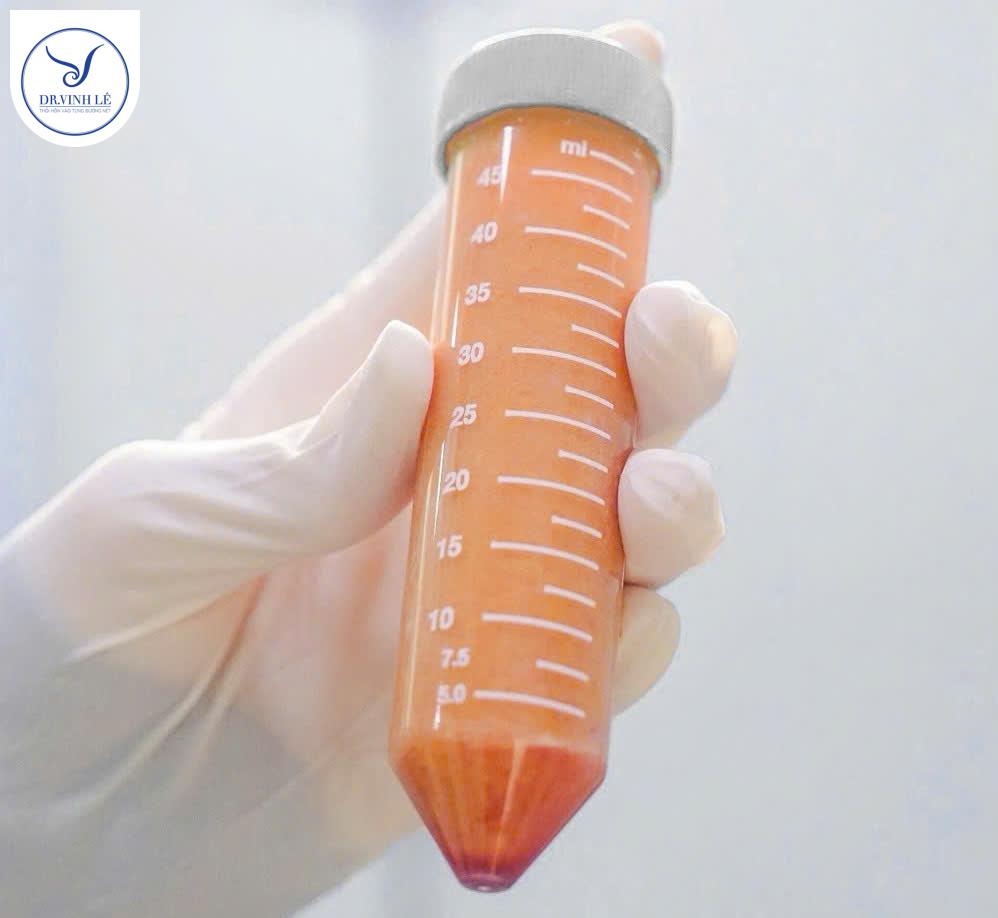 Quy trình cấy mỡ mông diễn ra như thế nào?